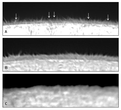 spicules.jpg